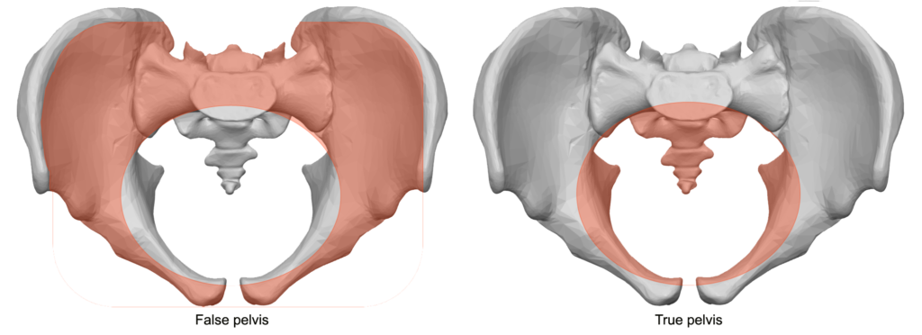 pelvis falsa vrs verdadera