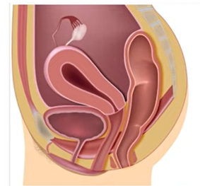 soporte y protección del contenido pélvico